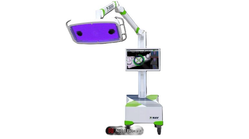 x guide nobel biocar